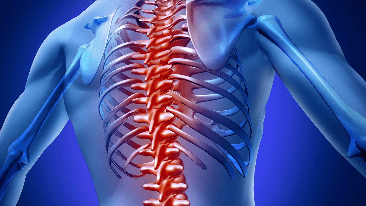 Osteochondrose der Brustwirbelsäule